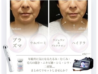 小顔ウナ学芸大学店(UNA)の写真