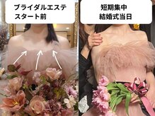 優子さんの美容矯正サロンの雰囲気（お腹/背中/腕の同時施術は、筋骨矯正効果&痩身力UP（池袋痩身））