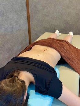 ハヤ治療院(HAYA治療院)/効果を出す鍼灸施術（２）