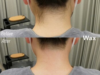 アイロンボーイ(IRONBOY)/うなじ+首筋WAX |脱毛ワックス