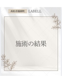 ラベージャ(La Bella)/