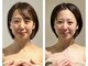 プルム(PURUMU)の写真/『一回の変化に驚く人、多数！』大人女性の歪み・たるみケア。本格骨格矯正で自分史上最小の小顔美人に♪