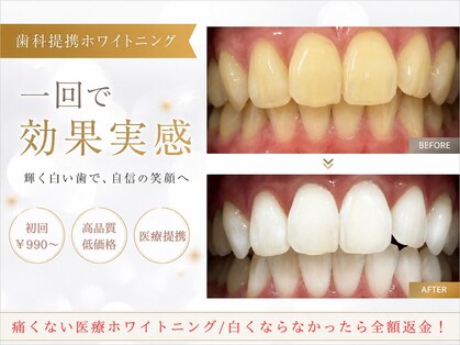 ルナベル(Luna Bell)の写真
