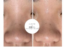 ベル(Belle)の雰囲気（角栓・黒ずみ一つ残さない丁寧な施術ならお任せ下さい！）