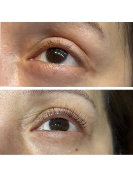 サロン ド スー(Salon de Suu)/マイラミネーション