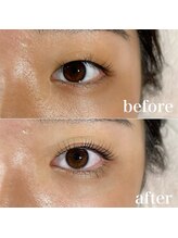 アイマ 北千住(imma)/ラッシュリフト