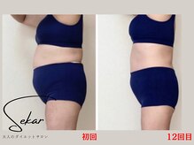 スカール(Sekar)の雰囲気（オールハンド痩身/ダイエット/リンパ）