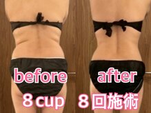 ユー(U)の雰囲気（50代　女性　脂肪冷却（腰肉/脇肉/お腹/浮き輪肉/脂肪をカット））