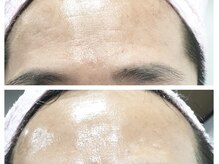 クリアー(CLEAR.)/【Before＆After】