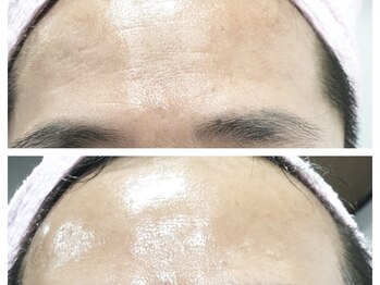 クリアー(CLEAR.)/【Before＆After】