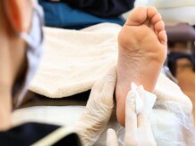厚木 海老名 巻き爪矯正センター/施術【8.消毒&汚れ除去】