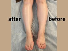 コボ ヘア アンド エステティック(COVO hair & esthetic)の雰囲気(《むくみスッキリ!》老廃物をしっかり流してひと回り小さい体に)