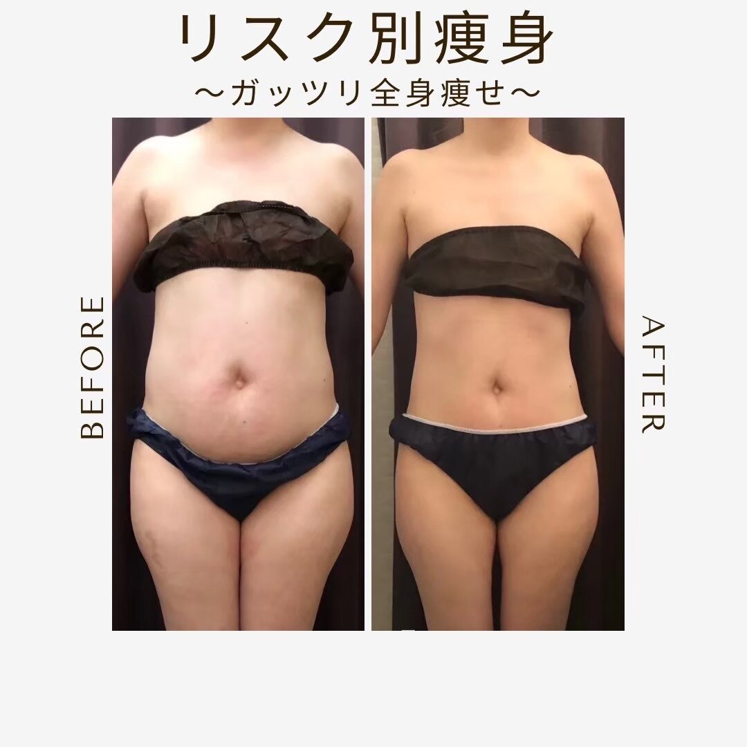 エステサロン 美飾り イオンモール木更津店｜ホットペッパービューティー