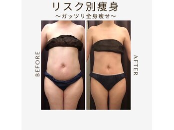 エステサロン 美飾り イオンモール木更津店