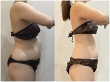 美容整体ウェリナ あま甚目寺院/小顔矯正/骨盤矯正/美脚サロン