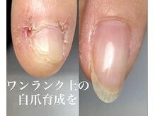 根本から爪を健康に育て縦長美爪に！悩まずご相談下さい…