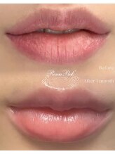 Kino Beauty Salon二子玉川店 ローマピンク/ホワイトラボ/脂肪冷却/シミ/メラニンケア/ローマピンク【唇/リップ】
