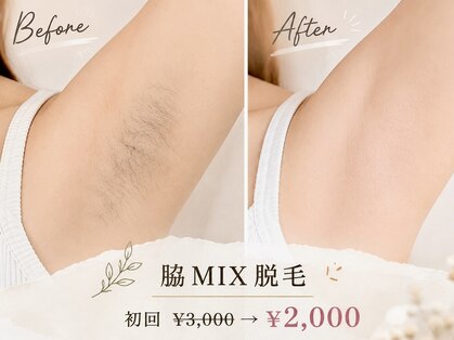 シェリラ(cherela)の写真