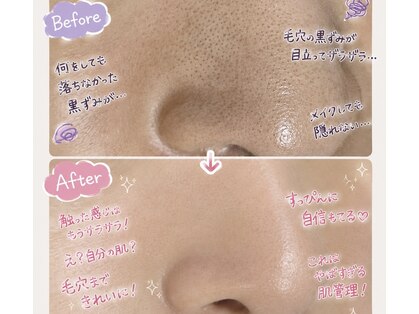 エステサロン オパール(OPALE)の写真