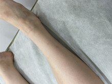 ナノハナ/鹿沼市全身脱毛美容室ナノハナ