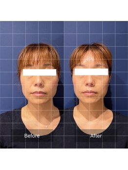 フフラ KANコルギセラピー山梨本店(fufla)/小顔ソムリエ【小顔 頭蓋骨】