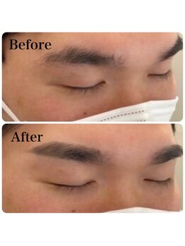 パウダーパレット さっぽろ地下街オーロラタウン店(POWDER PALETTE)/男性 before→after