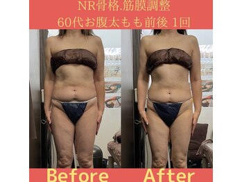 リラクゼーションサロン ラキ(laki)/NR筋膜骨格調整1回(痩身/肩こり)