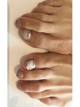 ブランシュ 藤沢(Blanche)/フット デザインコースゴールド