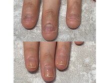 マイハニーネイルズ(My HONEY Nail's)の雰囲気（ジェルが出来ない方もケアでお爪と指先のお手入れができます。）