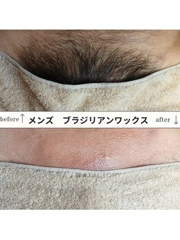 ビー ファクトリー(B FACTORY)/メンズ　VIOワックス