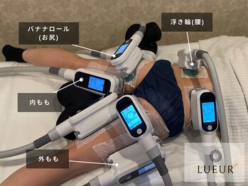 リュール横浜(LUEUR)の写真/【最先端の脂肪冷却機多数完備!!】脂肪冷却/小顔冷却/韓国腸活デトックスハーブで美ボディメイク