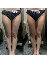 オンフリーク(ON FLEEK)/太ももの間に隙間を作ると・・