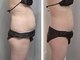 ポーモア(Pour moi)の写真/サイズダウンを叶える強力マシンで深部へアプローチ。頑固な脂肪とサヨナラし後ろ姿を美人へ♪