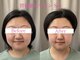 キアラ(chiara)の写真