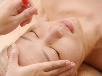 チュリップ(Tulipe)/毛穴の汚れをごっそり洗浄☆