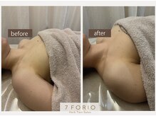 セブンフォリオ(7FORIO)/はっきりとわかるお肌の弾力