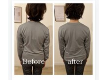 トトノウ 自由が丘店(totonou)/Before after (23)