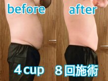 ユー(U)の雰囲気（30代　男性　脂肪冷却（お腹/浮き輪肉/脂肪をカット））