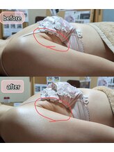 スノードロップ(snowdrop)/バストアップ　20代の方