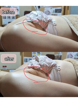 スノードロップ(snowdrop)/バストアップ　20代の方