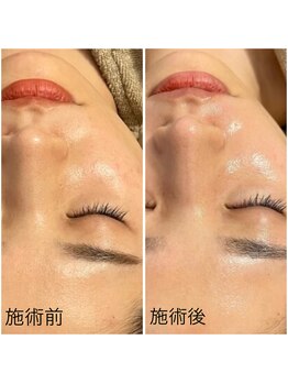 サロン ウーカ(salon WOOCA)/陶肌トリートメント(ipspセラム)