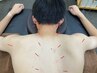 カラダ全身ケア　鍼灸施術+もみほぐし　全体60分　¥5,000