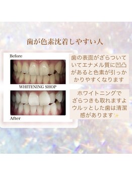ホワイトニングショップ 緑橋店/歯が茶色くなりやすい人は？！