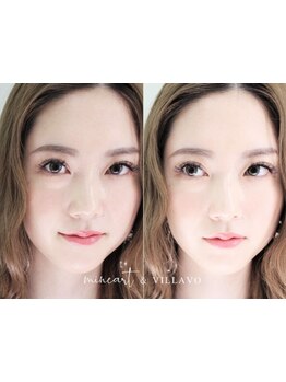 まつげのお悩み解決サロン