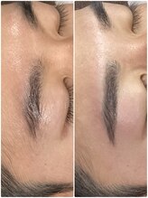 肌イズム 守谷店(肌ism)/