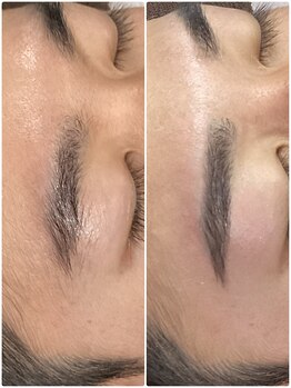 肌イズム 守谷店(肌ism)/