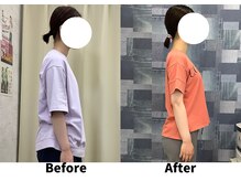 リセラ(Re:seraph)/Before After