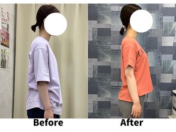 リセラ(Re:seraph)/Before After