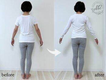 エーアール(AR)/【Before/After】10回目