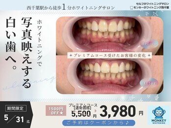 モンキーホワイトニング 西千葉の写真/【西千葉駅徒歩1分☆】歯のホワイトニング・セルフホワイトニング店！【完全個室】写真映えする白い歯へ♪
